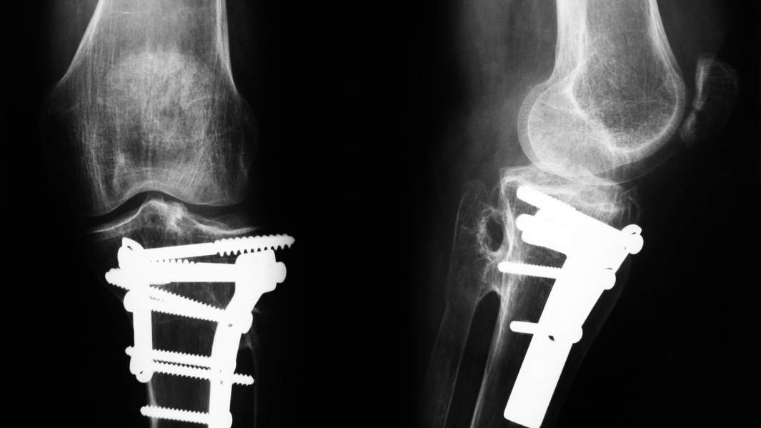 рентгеновский снимок