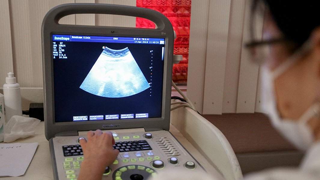 узи аппарат