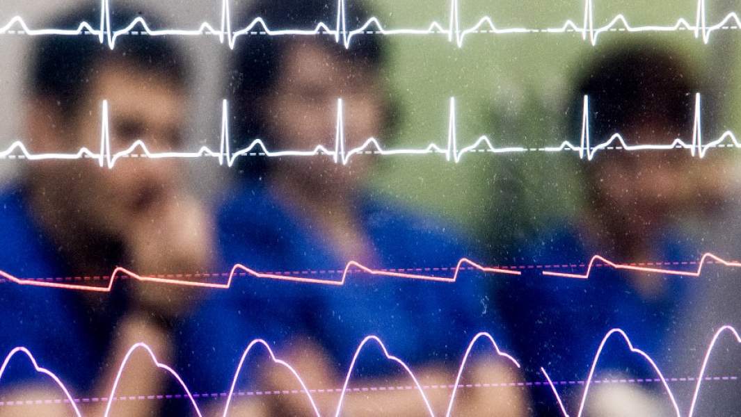 кардиограмма врачи