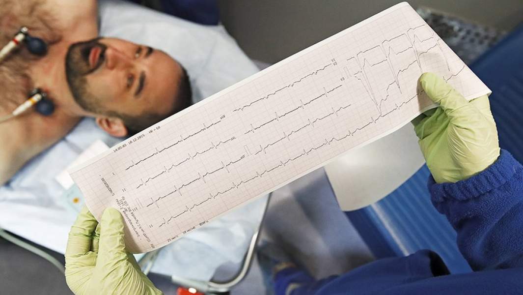 кардиограмма пациент