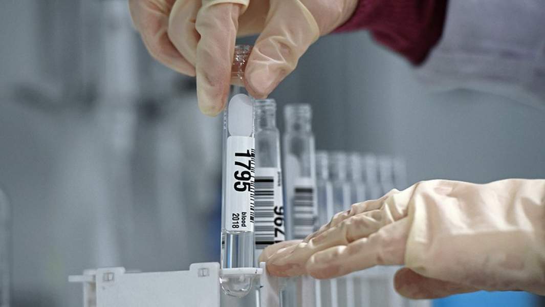 допинг пробы