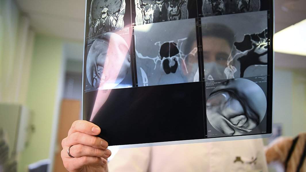 врач смотрит снимок пациента