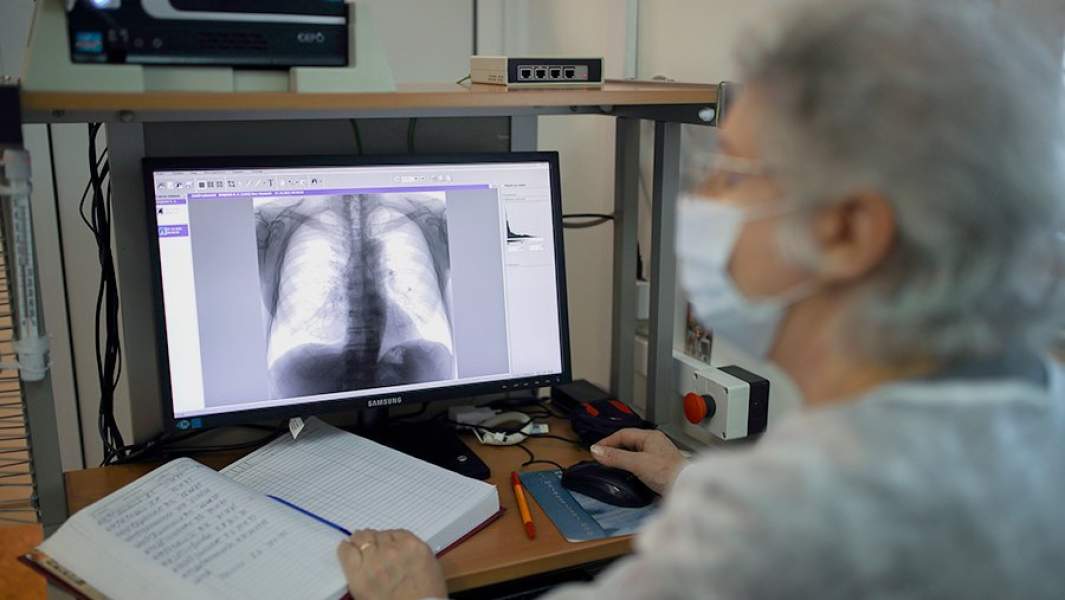 Рентген грудной клетки