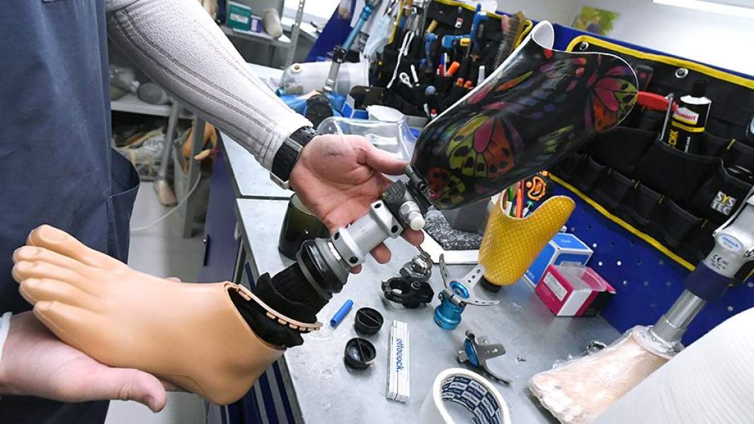 Специалист работает над изготовлением протеза нижней конечности для пациентки