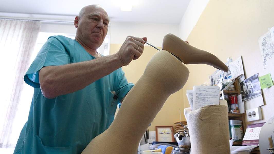 Изготовление протеза левой ноги