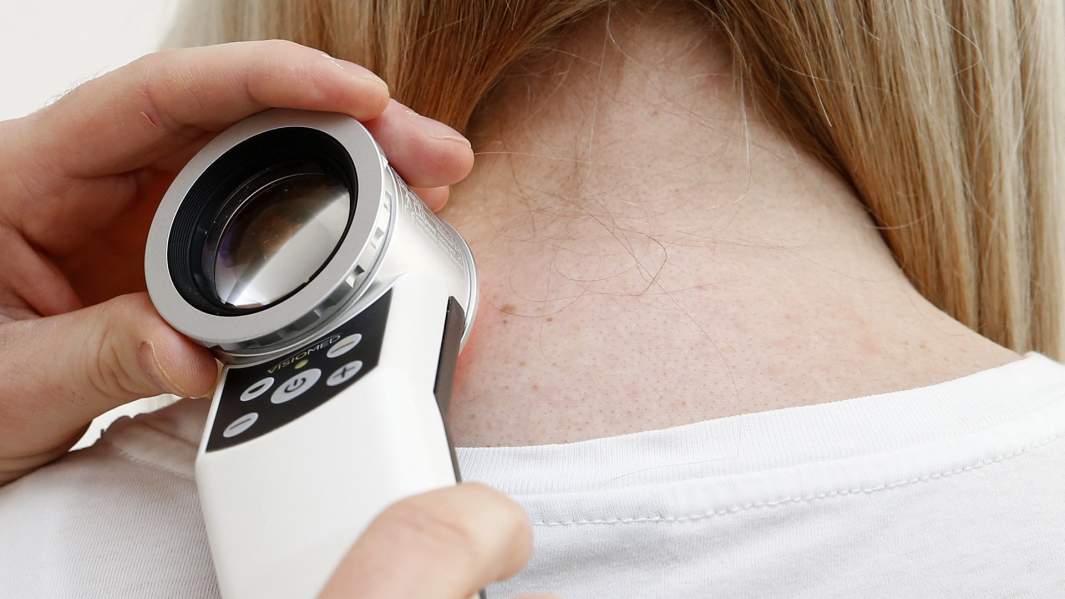 дерматолог исследование кожа