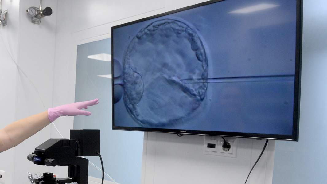 клетка оплодотворение микроскоп