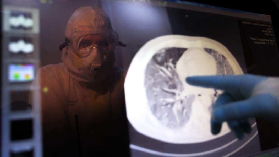 снимок мозга врач монитор