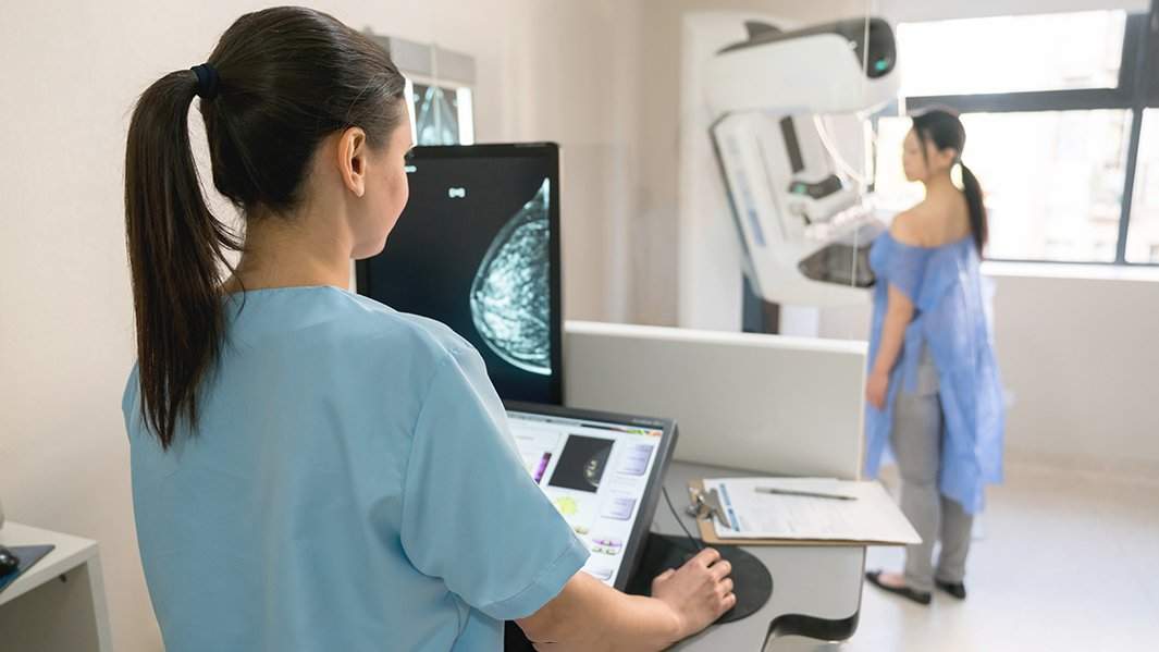 маммография