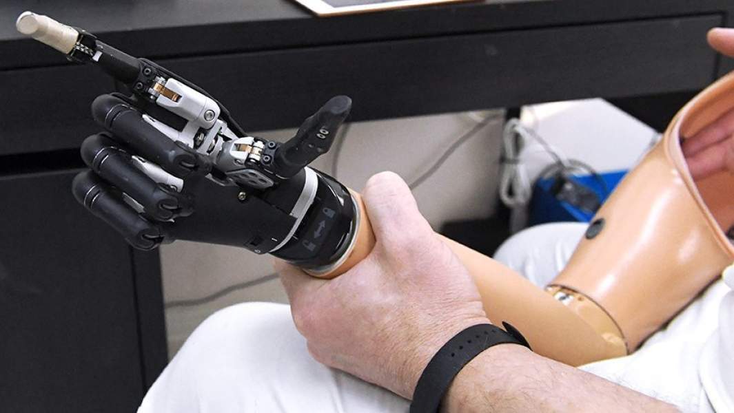 Инженер проводит настройку протеза руки с микропроцессорным управлением