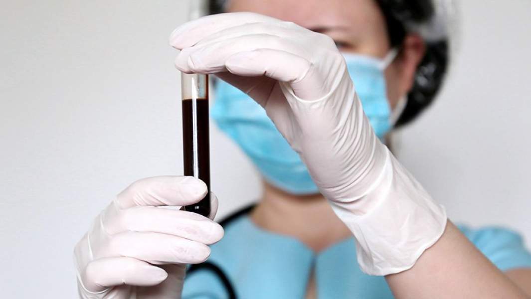 анализ крови