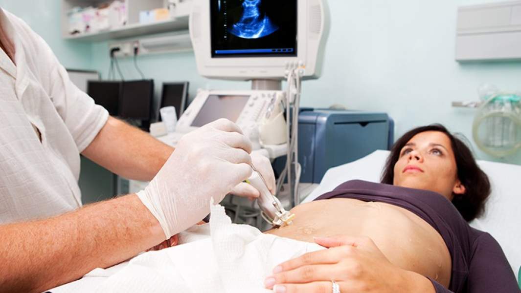 УЗИ органов брюшной полости