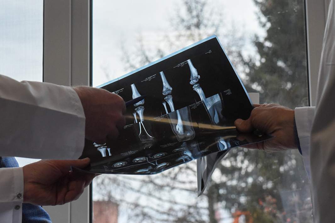 Рентгеновский снимок кости