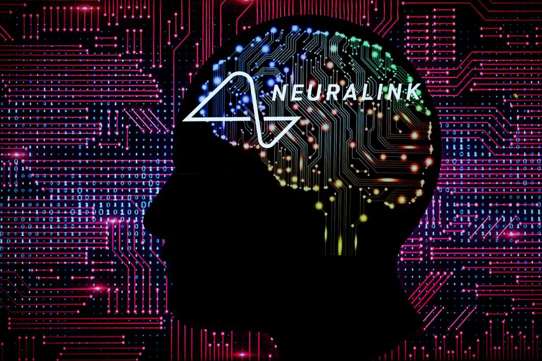Neuralink 