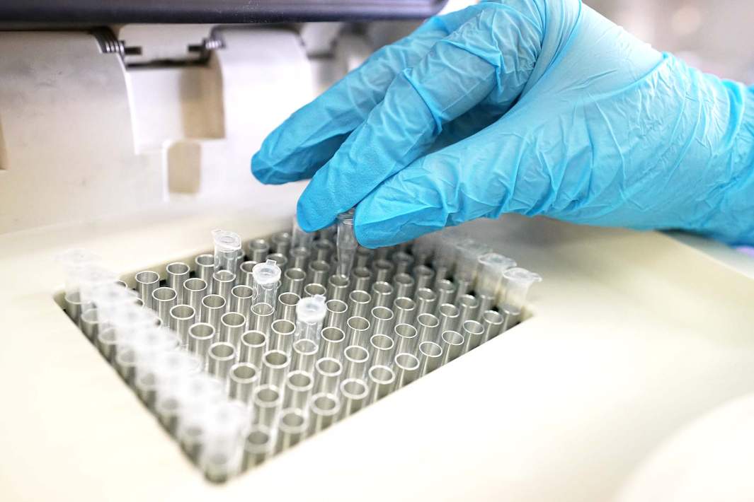 test tubes samples a hand in a medical glove takes out a test tube sample