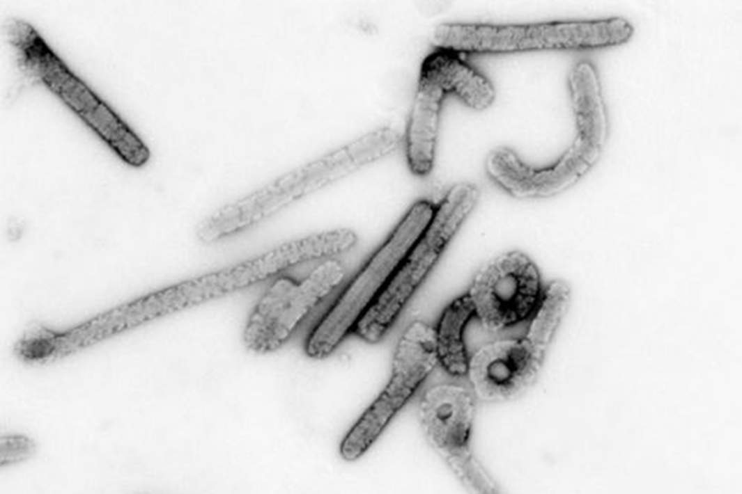 Вирус Марбург под увеличением примерно в 100000 раз