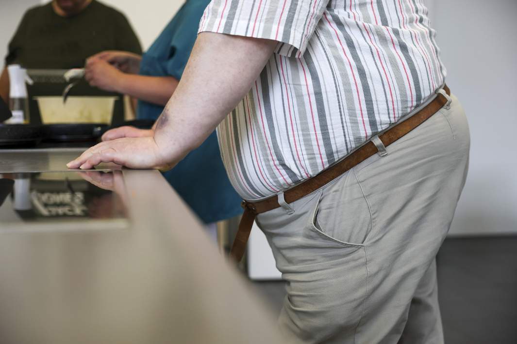 Мужчина с ожирением 