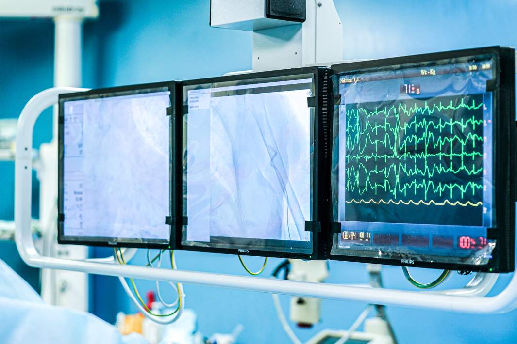 Кардиограмма