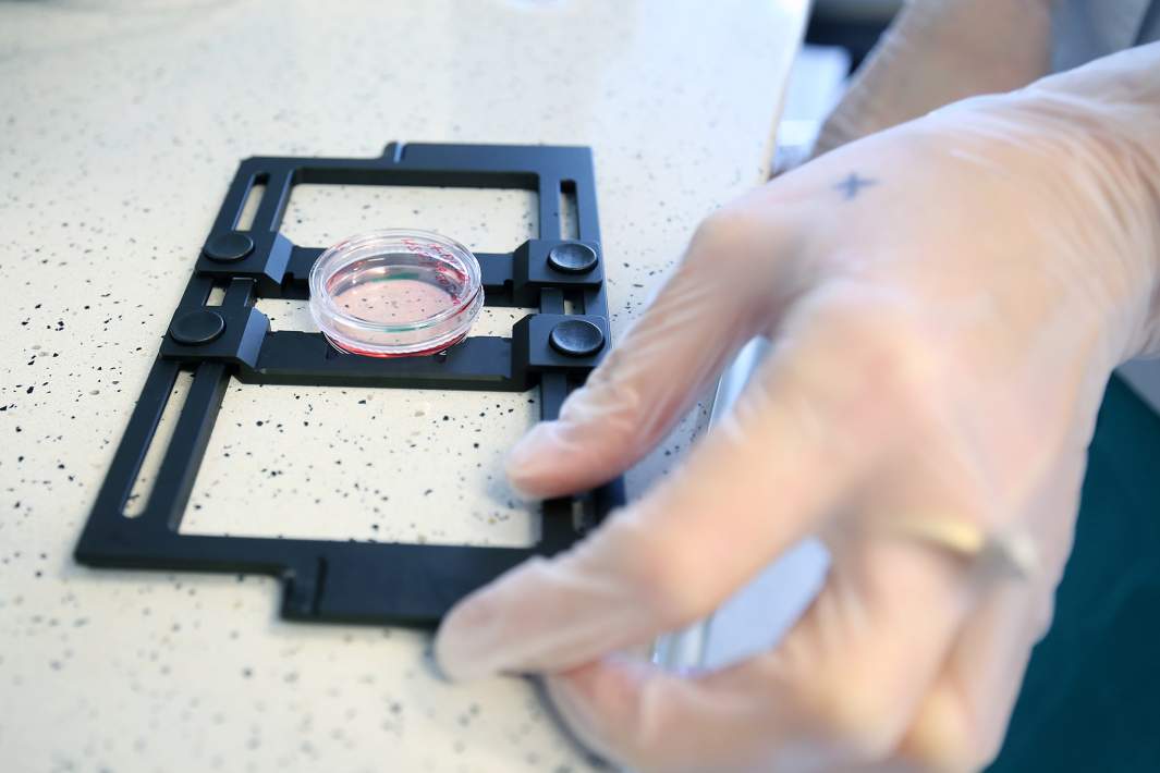 Образцы клеток для изчучения под микроскопом