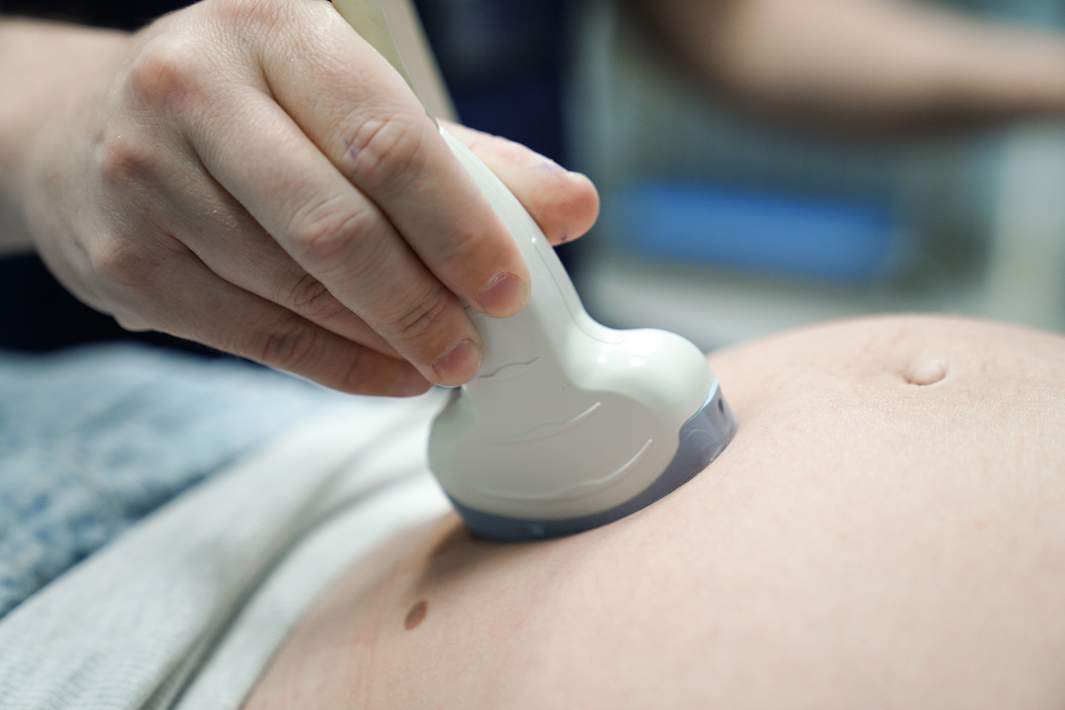 Беременность