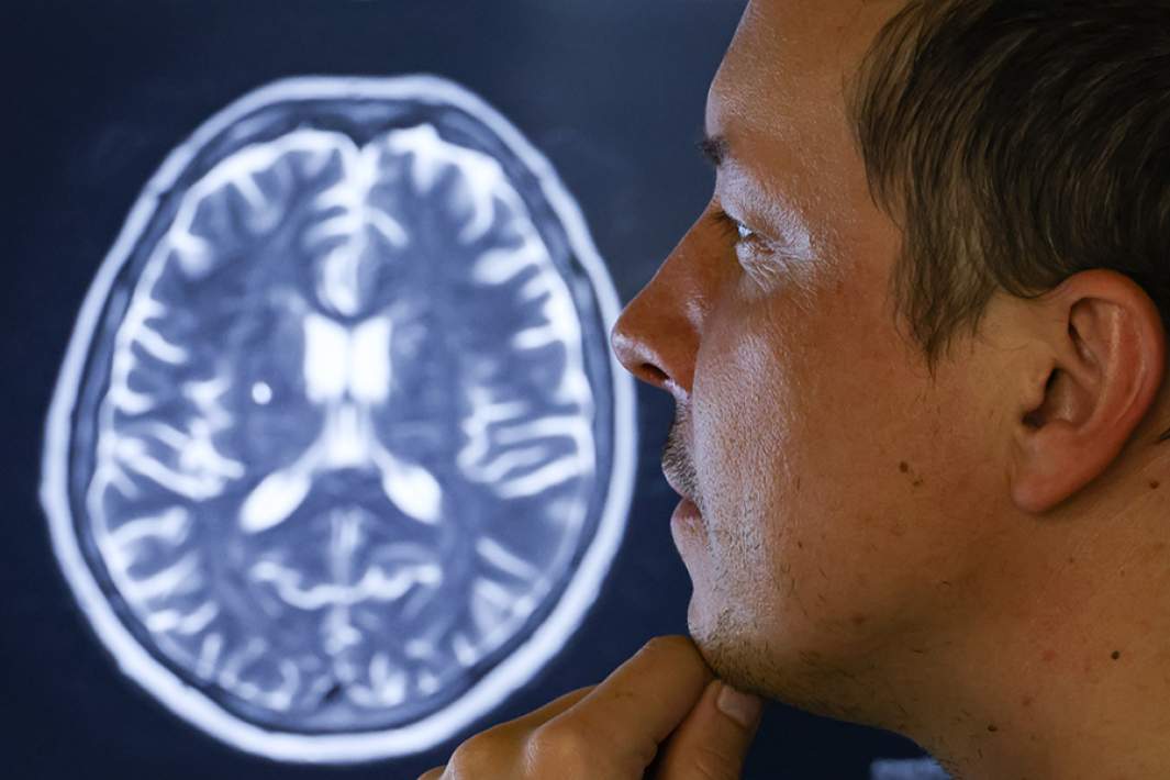 МРТ мозга