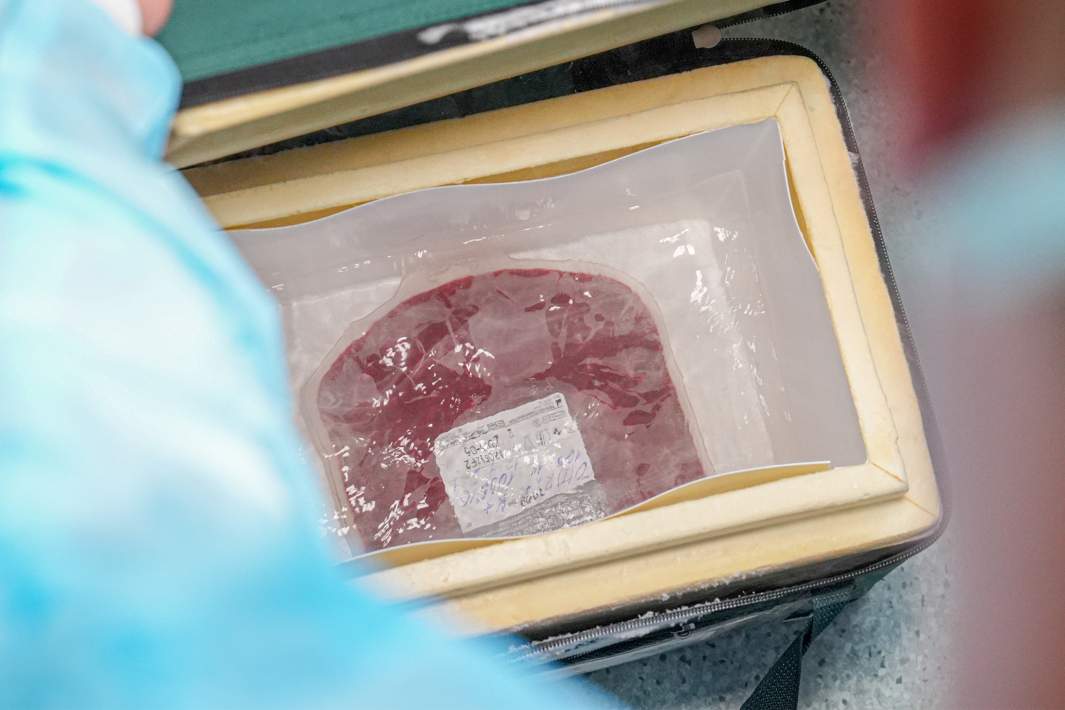 Костный мозг