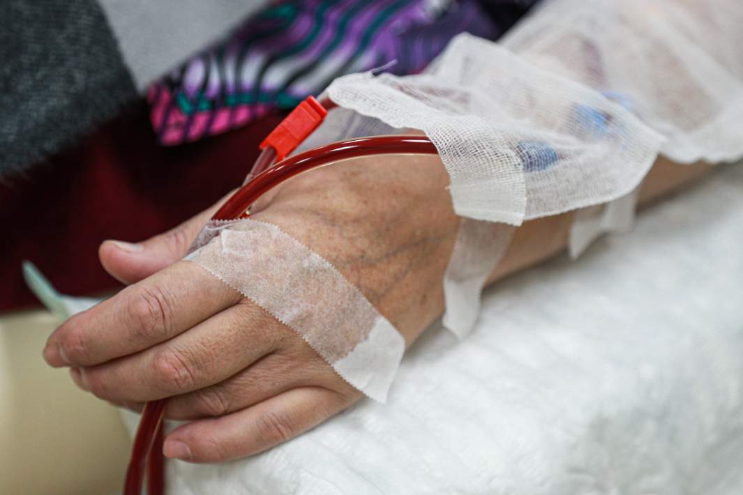 Гемодиализ