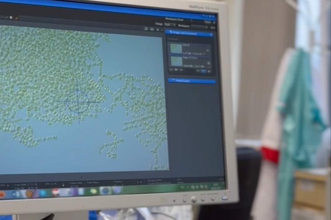 Изучение морфологии и фотофиксация штаммов Microcystis aeruginosa на световом микроскопе