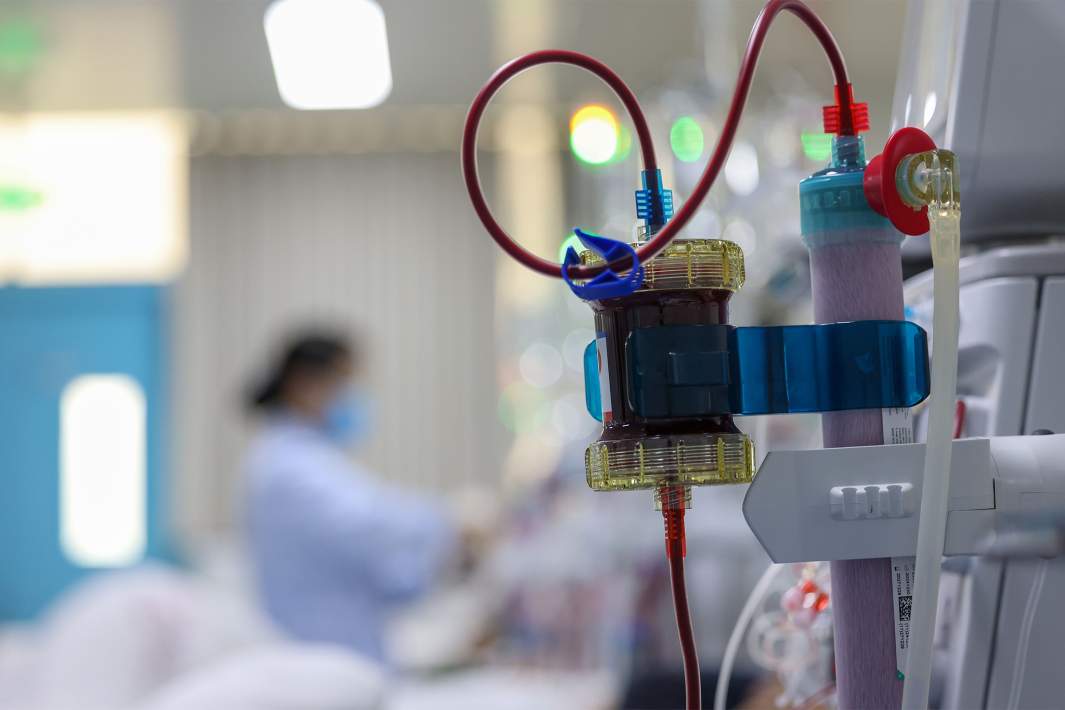 Гемодиализ