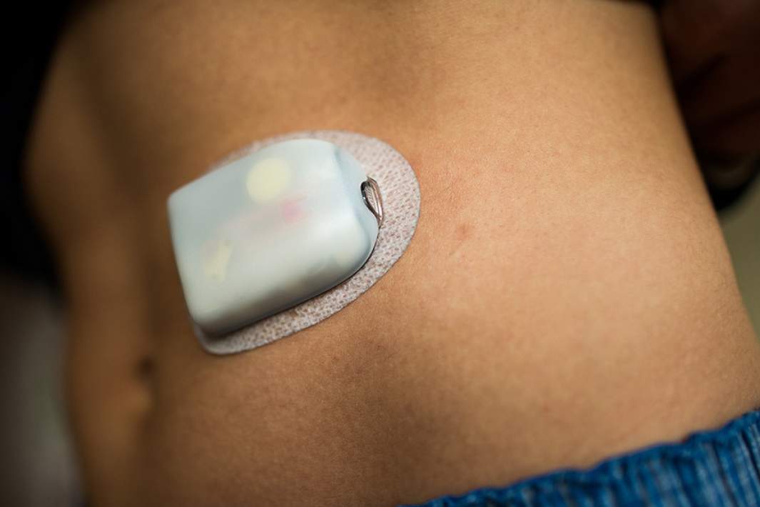 Инсулиновая помпа 