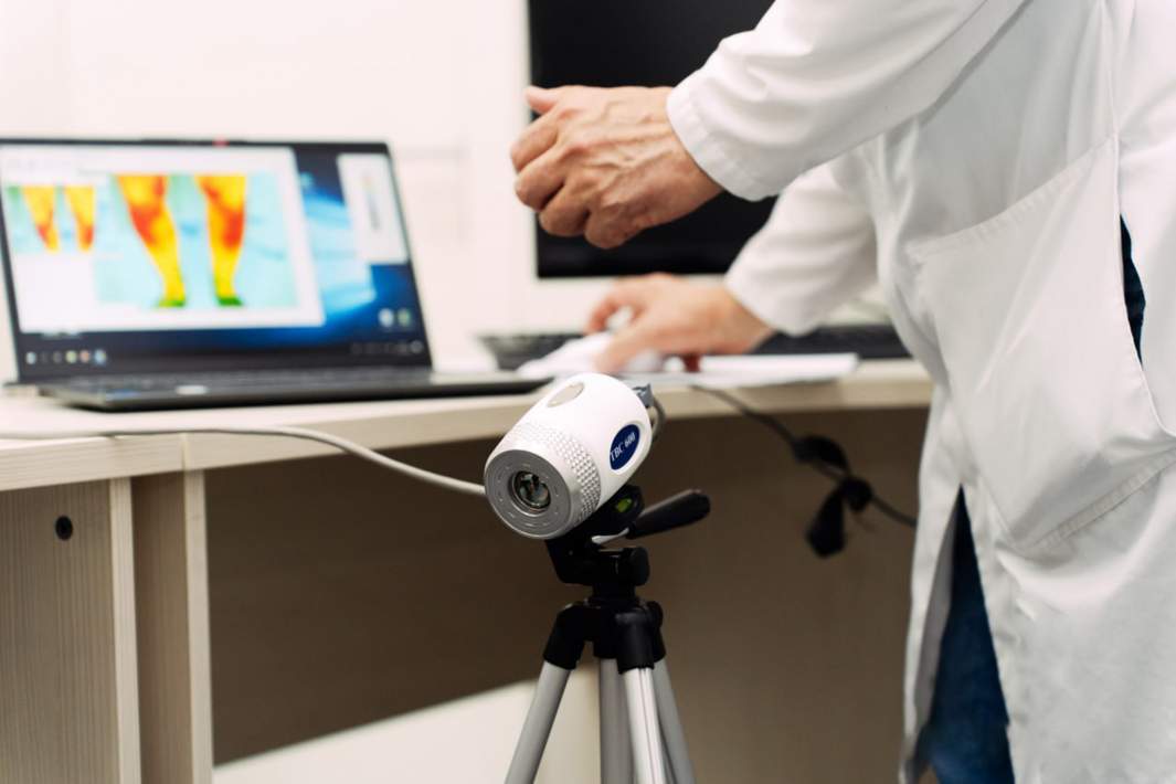 тепловизор