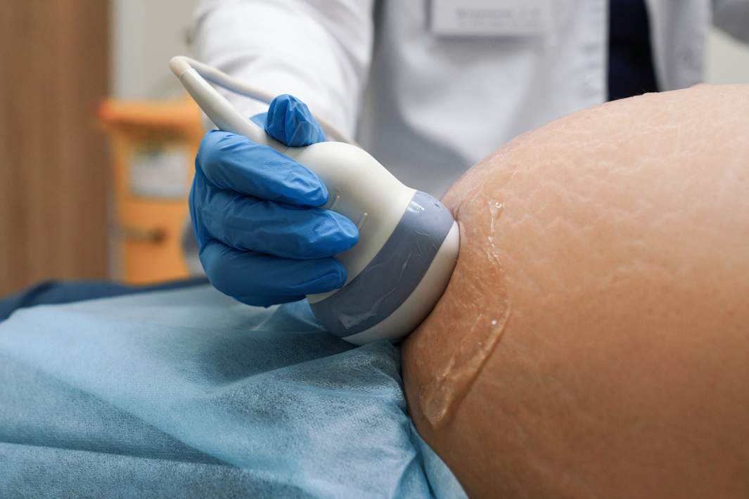 беременность