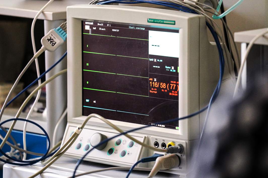 Ритм сердца