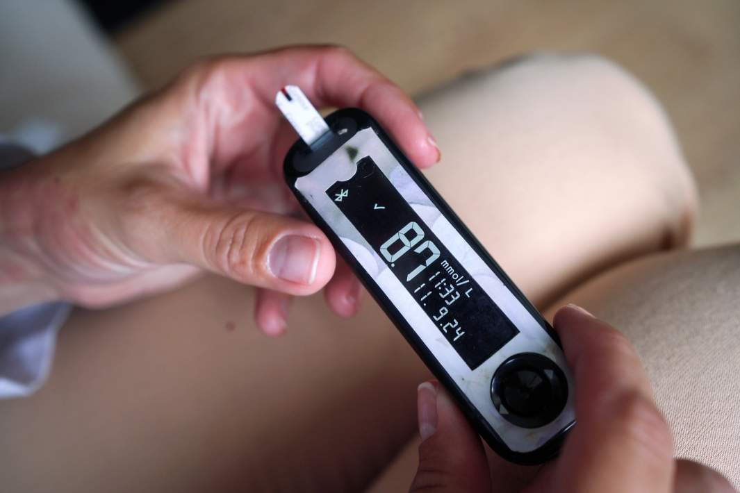 Сахарный диабет