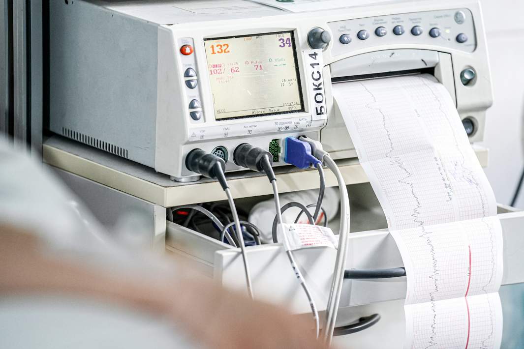 Аппарат ЭКГ в палате реанимации 