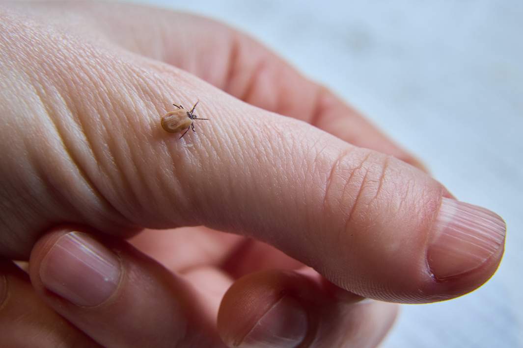 Клещ на руке 