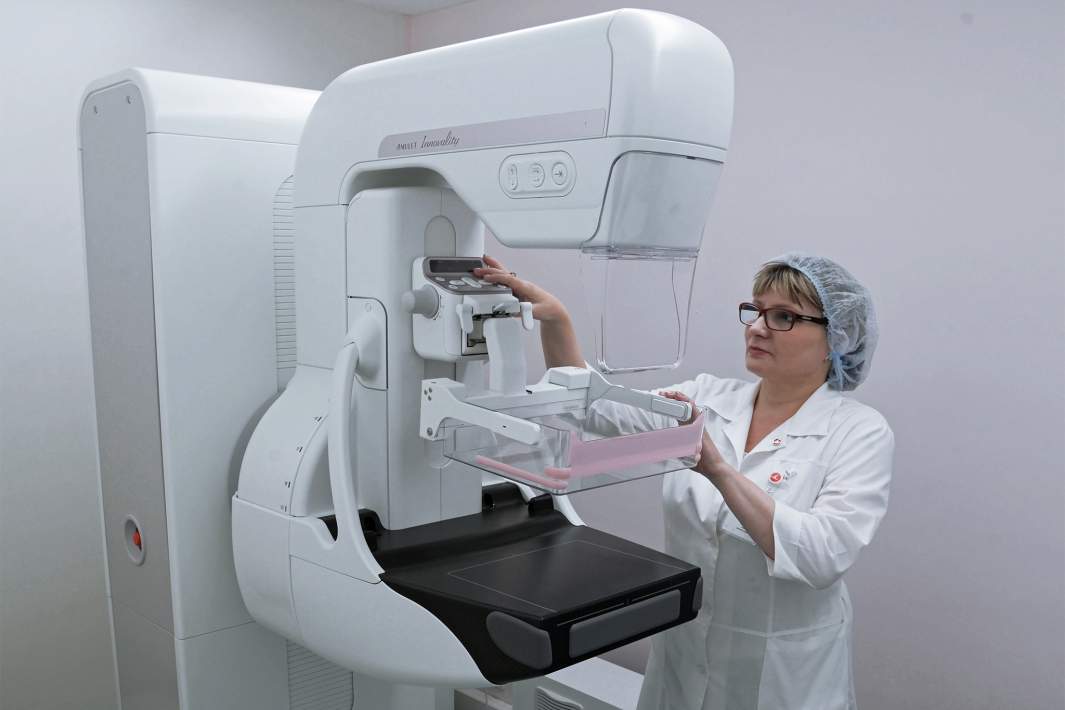 Маммография