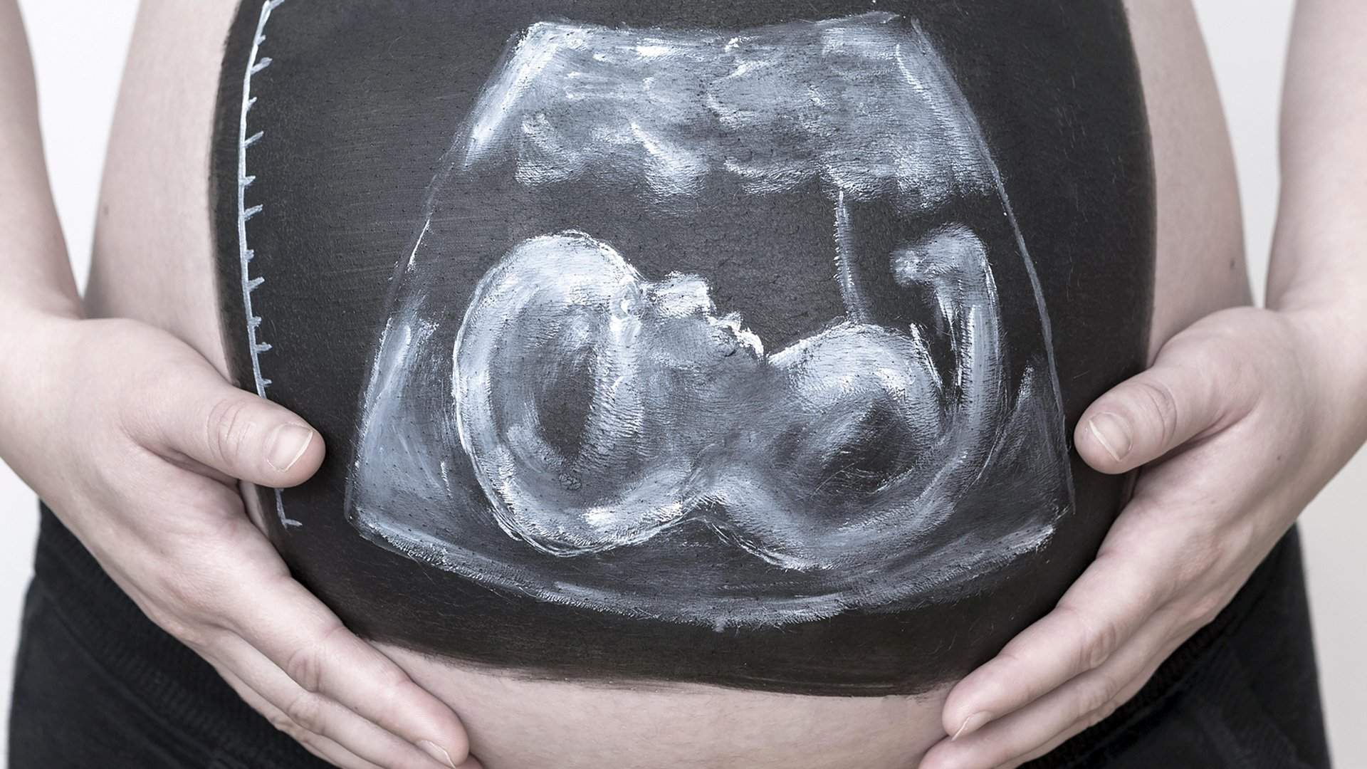 Подсадка эмбриона суррогатной матери. Эко бесплодие. Эко картинки для девушек. Эко беременность картинки.