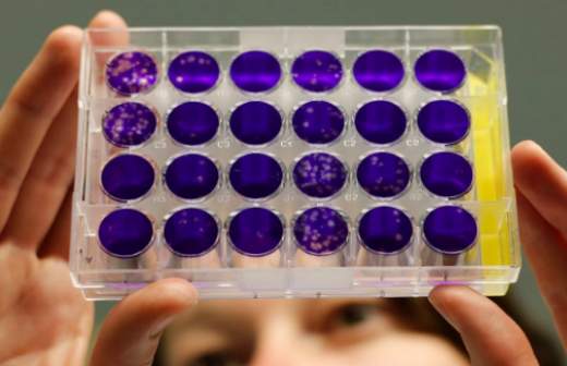 Случай бубонной чумы в Киргизии опасен для России