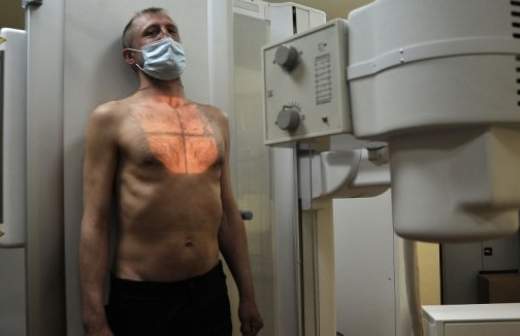 Больных туберкулезом предлагают лечить принудительно до суда