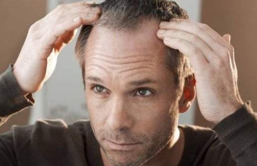 Science: ученые нашли ген, который отвечает за облысение