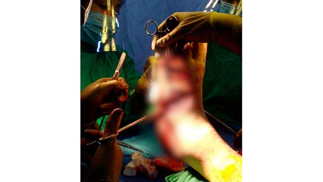 Нападение акулы