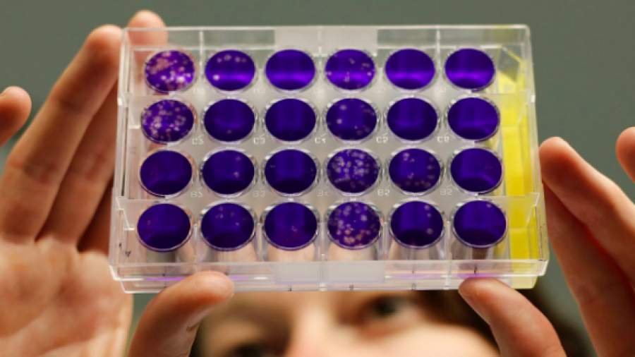 Случай бубонной чумы в Киргизии опасен для России