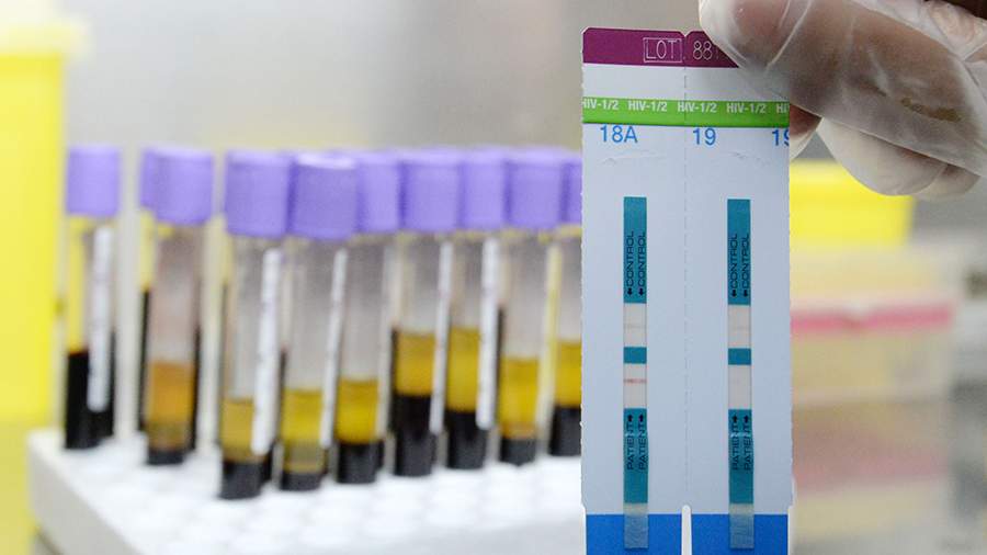 Highly contagious strain of HIV identified in the Netherlands Highly contagious strain of HIV identified in the Netherlands