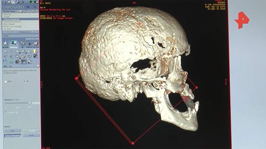 The UK spoke about the process of identifying the remains of the royal family