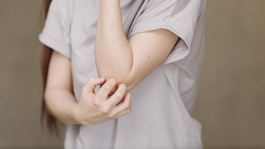 Ученые выявили связь атопического дерматита с нарушениями сна и памяти