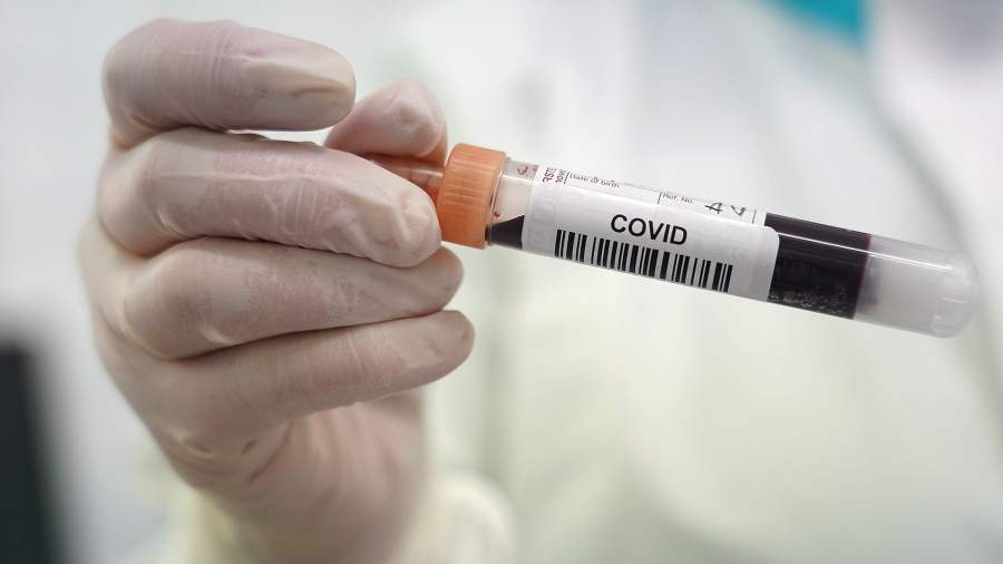 коронавирус тест