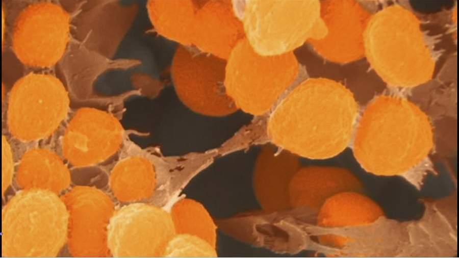 В США рассказали об устойчивой к антибиотикам супербактерии