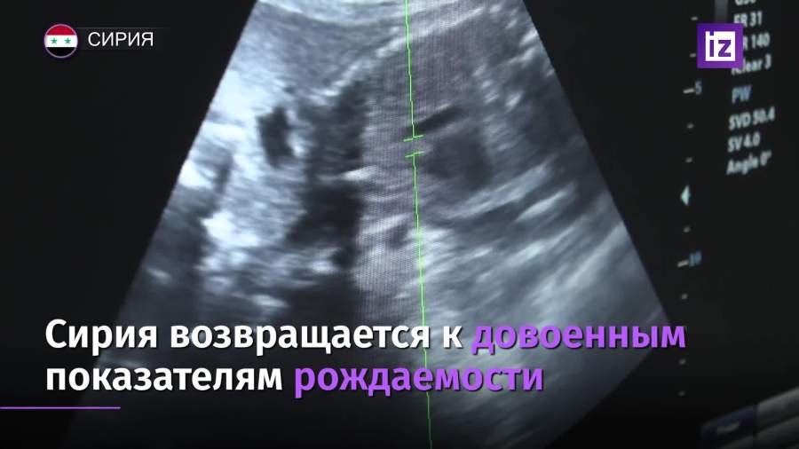 Сирия возвращается к довоенным показателям рождаемости