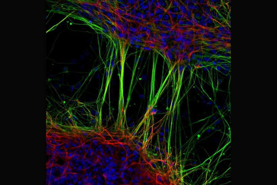 Nikon Small World 2022